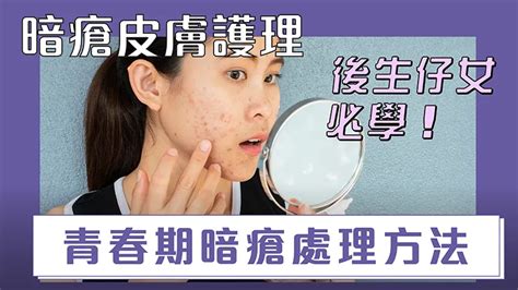 暗瘡皮膚護理｜後生仔女必學青春期暗瘡處理方法 Dailynewspot