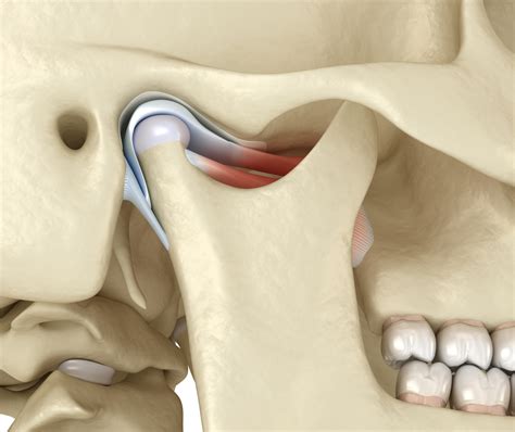 Telling The Difference Between Tmj And Tmjd Aesthetic Dentistry San