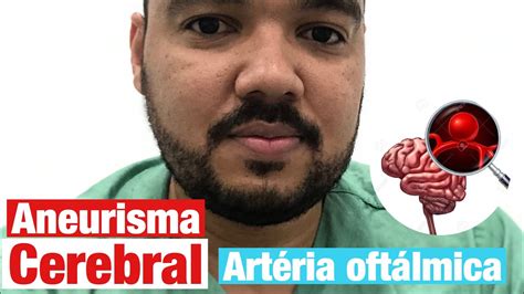 Aneurisma Cerebral Segmento Oft Lmico Da Car Tida Interna Youtube