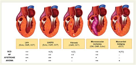 Figure 1 From Role Of Multimodality Cardiac Imaging In The Management