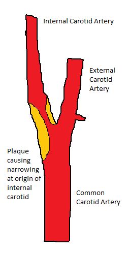 Irish Vascular