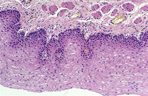 Stratified Squamous Epithelium Lm Stock Image C0252699 Science