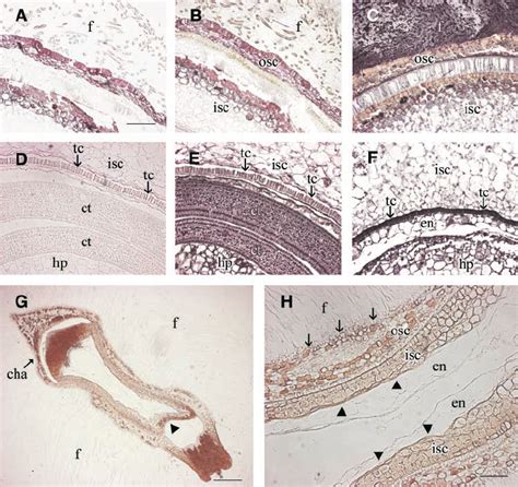 Immunogold Localization Of Sus Protein In Type I And Type Ii Seeds Of