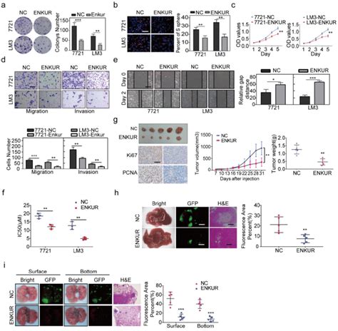 Enkur Inhibits Hcc Proliferation Metastasis And Sorafenib Resistance Download Scientific