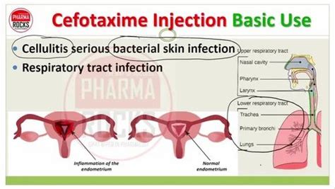 Cefotaxime Injection 1000mg Packaging Size 1 Gm At Rs 44 50 Vial In