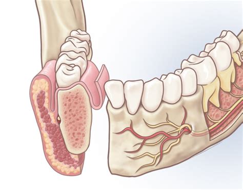 Brandon Stelter - Alveolar Ridge Anatomy