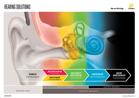 cochlear limited bruce dalys folio site