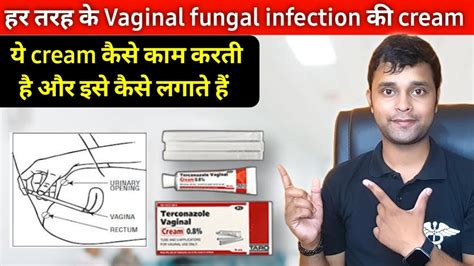 Terconazole Cream For Vaginal Fungal Infection Terconazole Cream How To Use Vaginal