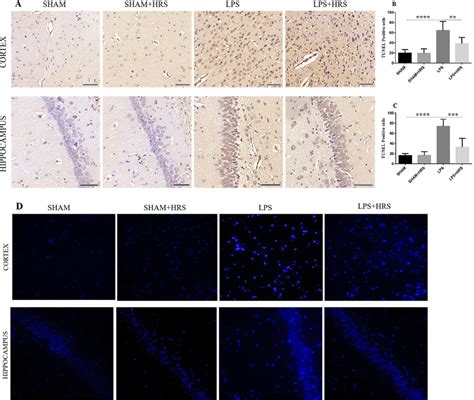 HRS Effects In Neuronal Apoptosis In The Cerebral Cortex And