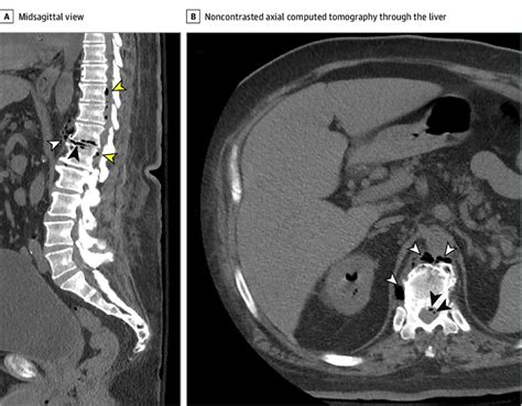 Computed Tomography Of The Abdomen And Pelvis Download Scientific Diagram