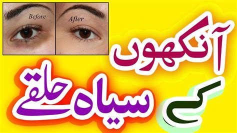 Eye Dark Circle Remover Home Remedy Tips In Urdu آنکھوں کے سیاہ حلقے