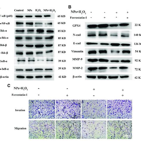 Ppy Fe O Nps Suppress Cell Migration And Invasion And Promote Cell