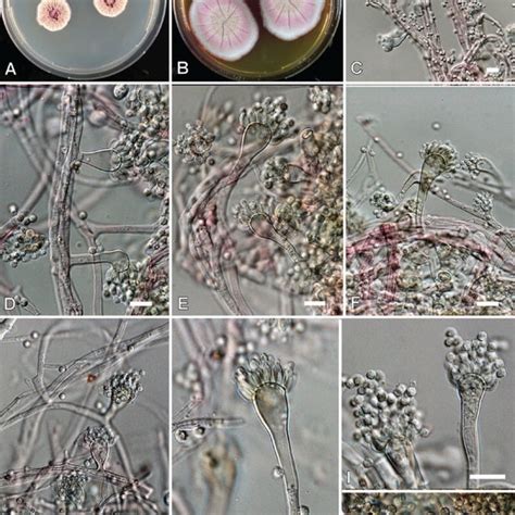 Aspergillus Fumigatus A C Colonies 7 D 25 C A CYA B MEA C CYA