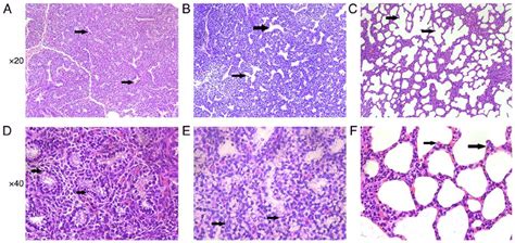 Morphological Observation Of Fetal Lung Tissues In Three Groups Download Scientific Diagram