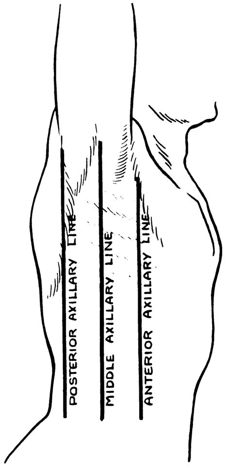 Axillary lines - Wikipedia