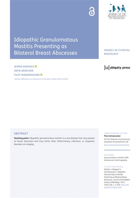 PDF Idiopathic Granulomatous Mastitis Presenting As Bilateral Breast