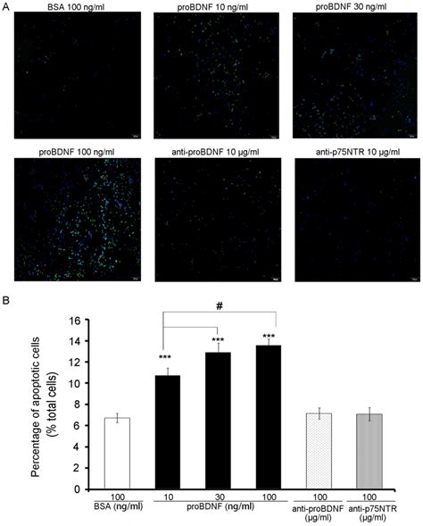 Probdnf Inhibits The Proliferation And Migration Of Oln Oligodendrocytes