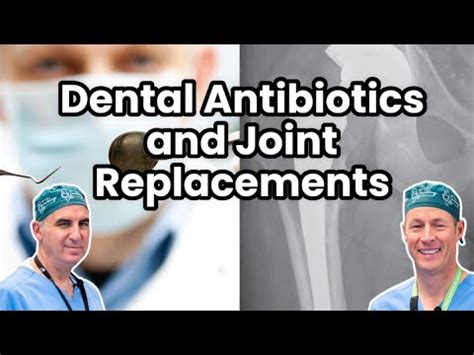 Do You Need Antibiotics Before Dental Work If You Have A Joint