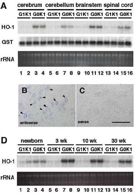 Expression of glycine receptor ␣ 1 and ␤ subunits in the CNS of small ...