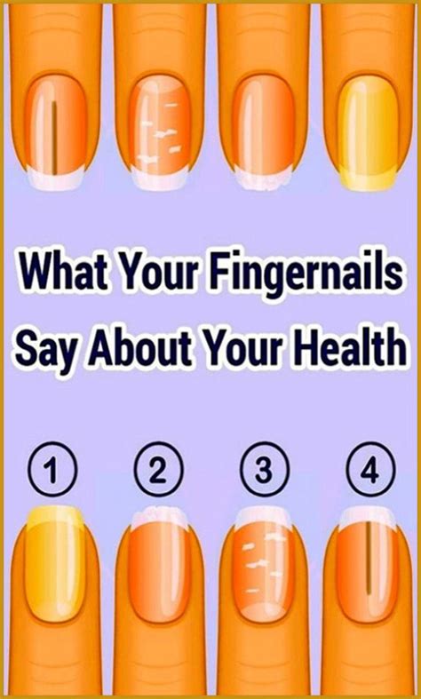 This Is What Your Fingernails Say About Your Health In 2020 Health