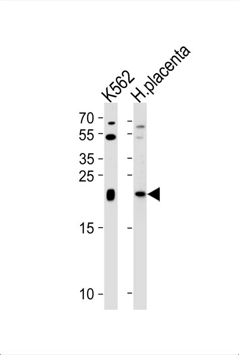 Il Antibody N Term Affinity Purified Rabbit Polyclonal Antibody