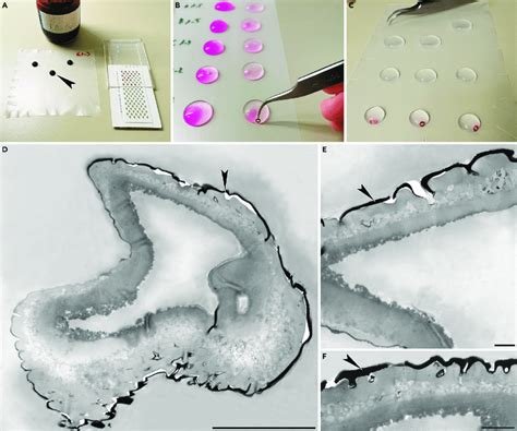 Transmission Electron Microscopy Staining And Analysis A The Download Scientific Diagram