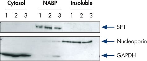 Qproteome Nuclear Protein Kit