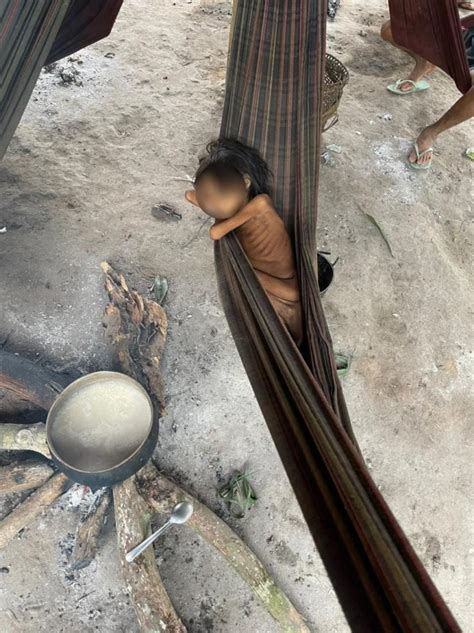 Fome foto de criança indígena Yanomami agonizando alerta o Brasil