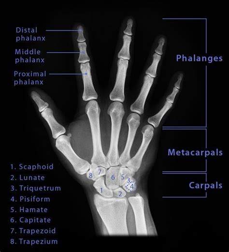 Hand Bones Names And Structure With Labeled Diagrams