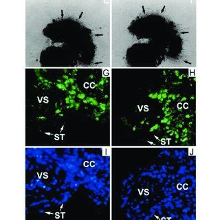 Kisspeptin Raises Intracellular Ca In Isolated First Trimester