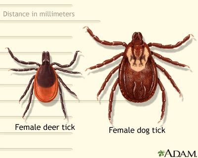 Deer Tick Vs Dog Tick Bite