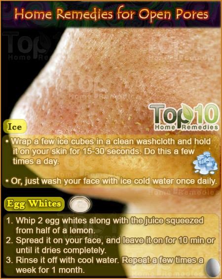 Home Remedies for Open Pores | Top 10 Home Remedies