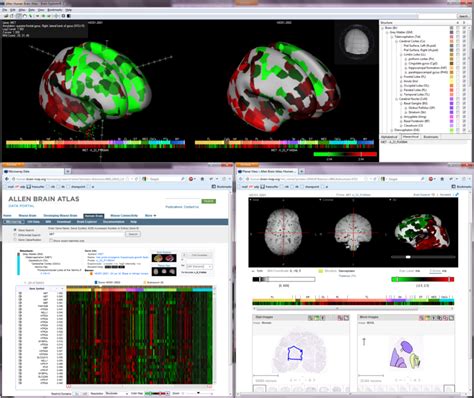 The Allen Human Brain Atlas contains multimodal data integrated into a ...