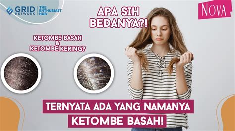 Perbedaan Ketombe Kering Dan Ketombe Basah Apa Saja Sih YouTube