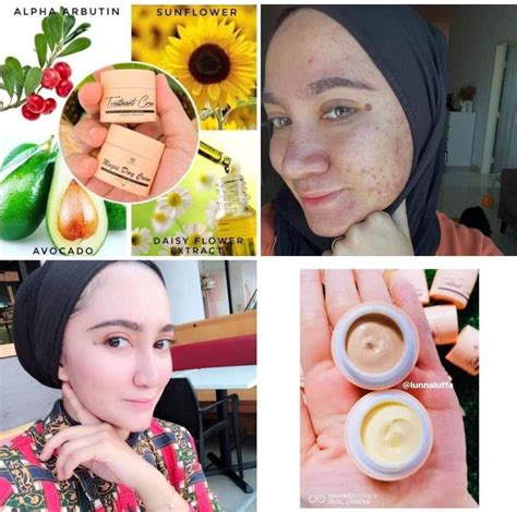 Puteri Ratu Magic Day Cream Testimoni Puteri Ratu Treatment Cream Magic Day Cream Shopee