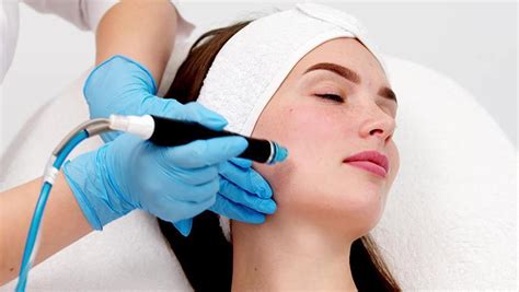 The Magic Of Microneedling Rejuvenate Your Skin Naturally Tamira Life