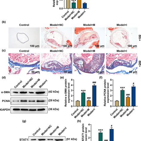 Stat Was A Direct Target Gene Of Mir P A Targetscan Predicted