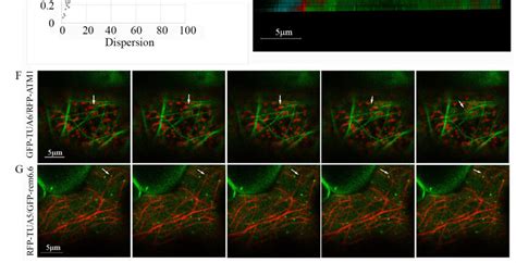 Coordinated Organization Of Atm1 Iq Tail And Cortical Mts 35s Gfp Tua6