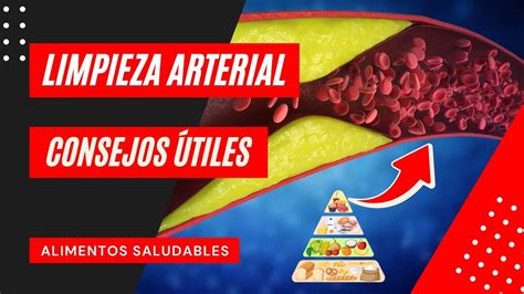 Descubre Cómo Limpiar Tus Arterias Con Estos 10 Alimentos Saludables Youtube