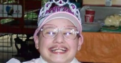 Gypsy Roses Teeth: A Story of Severe Dental Challenges