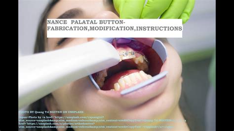 NANCE PALATAL ARCH USES FABRICATION MODIFICATION IN ORTHODONTICS