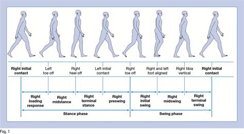 Types Of Gait Patterns