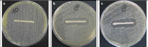 Typical Pictures Of Agar Plates Showing The Inhibition Zones Generated