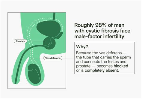 Understanding Cystic Fibrosis Cftr Gene Legacy