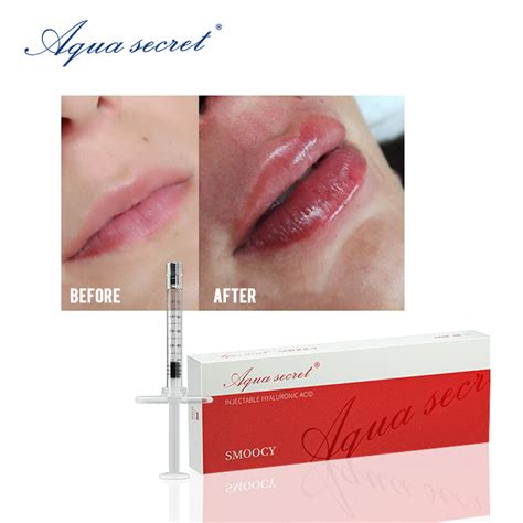 Aqua Secret Injectable Ml Ml Dermal Filler Ha Hyloronic Acid Lip