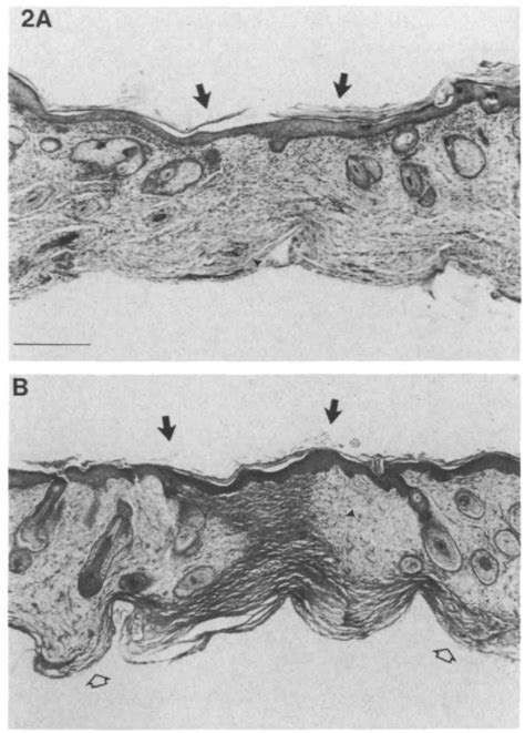 Figure 1 From Scarless Wound Repair A Human Fetal Skin Model