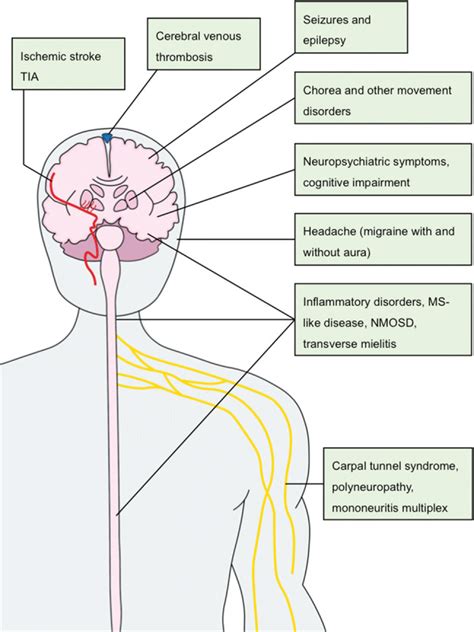 Neurologic Manifestations Of The Antiphospholipid Syndrome An Update