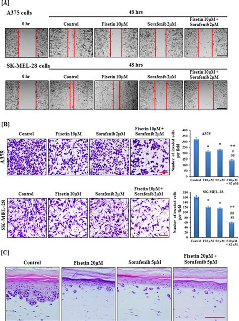 Effect Of Fisetin Sorafenib And Their Combination On Migration And