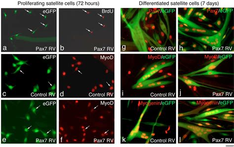 PDF Pax7 And Myogenic Progression In Skeletal Muscle Satellite Cells