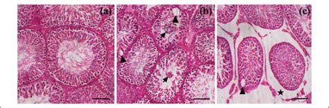 Hematoxylin And Eosin Stained Sections Of Rat Testis A Testis Of Download Scientific Diagram